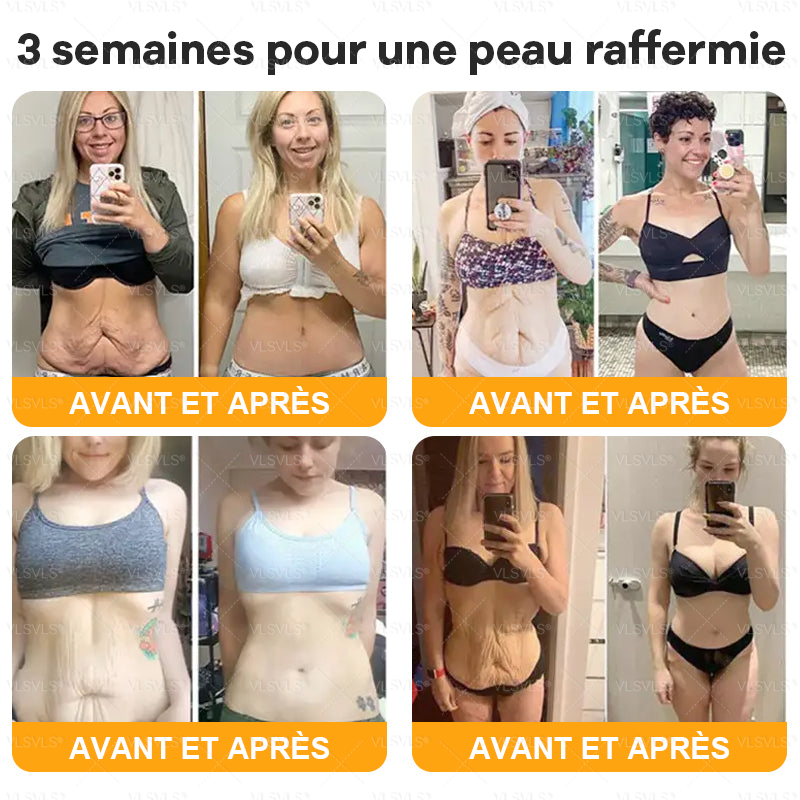 VLSVLSÂźđđđ Il ne reste plus que 10 pots ! Nous vous offrons une remise supplĂ©mentaire de 30 % ! Prenez soin de votre silhouette et de votre santĂ©. Si vous manquez cette offre maintenant, vous nâaurez plus dâoccasion avant lâannĂ©e prochaine.