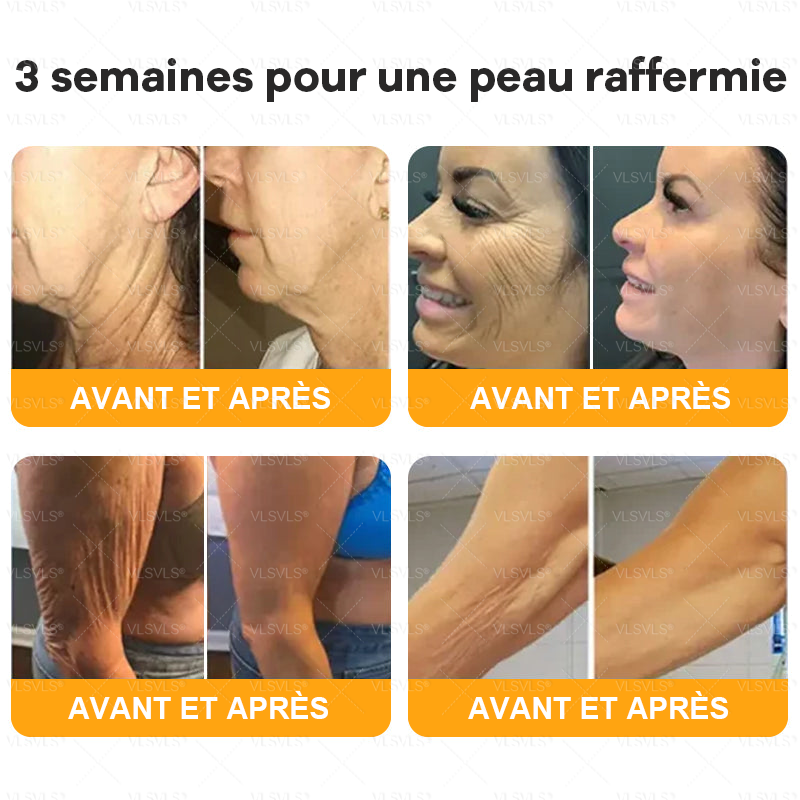 VLSVLSÂźđđđ Il ne reste plus que 10 pots ! Nous vous offrons une remise supplĂ©mentaire de 30 % ! Prenez soin de votre silhouette et de votre santĂ©. Si vous manquez cette offre maintenant, vous nâaurez plus dâoccasion avant lâannĂ©e prochaine.