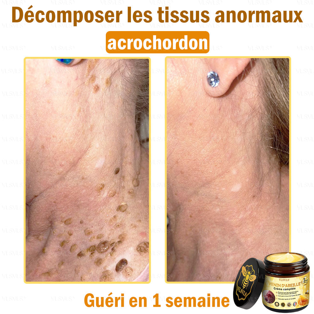 🎁🎁🎁 Il ne reste que 5 pots ! Nous vous offrons une remise supplémentaire de 50 % ! Mettez-vous en forme et en bonne santé. Si vous manquez cette offre, vous n'aurez pas d'autre chance avant l'année prochaine.