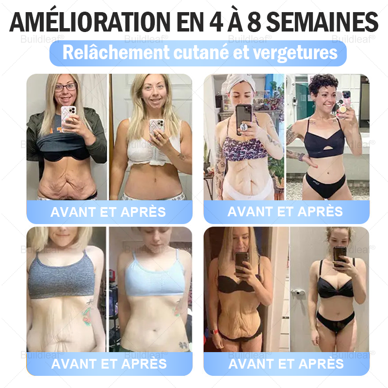 Buildleaf®🎁🎁🎁 Dernière chance ! Saisissez cette opportunité exceptionnelle avec 50 % de réduction !