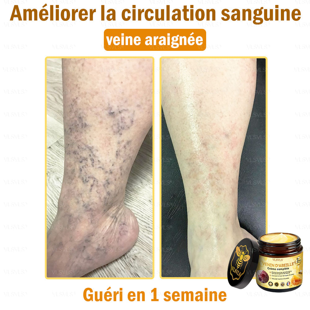 🎁🎁🎁 Il ne reste que 5 pots ! Nous vous offrons une remise supplémentaire de 50 % ! Mettez-vous en forme et en bonne santé. Si vous manquez cette offre, vous n'aurez pas d'autre chance avant l'année prochaine.