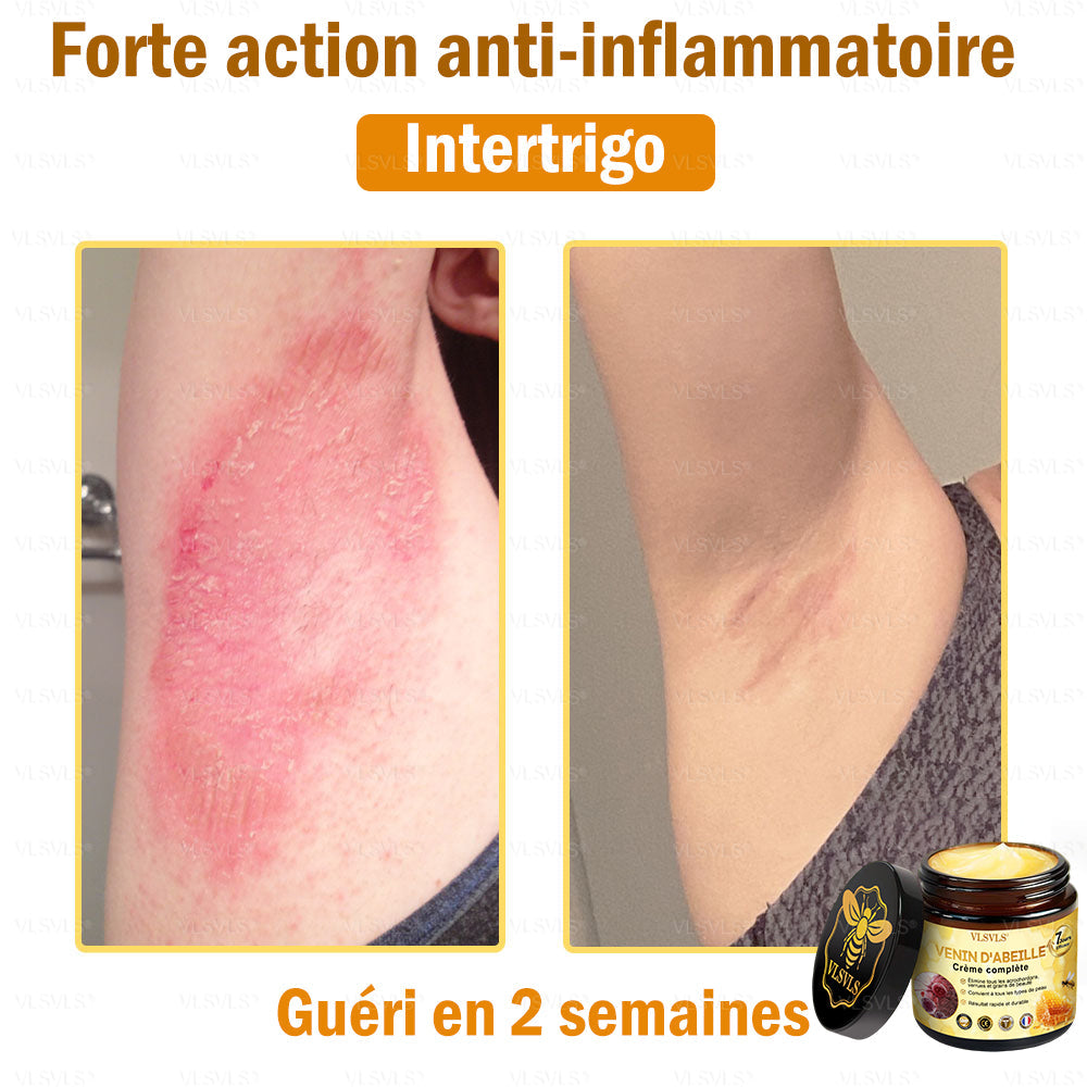 🎁🎁🎁 Il ne reste que 5 pots ! Nous vous offrons une remise supplémentaire de 50 % ! Mettez-vous en forme et en bonne santé. Si vous manquez cette offre, vous n'aurez pas d'autre chance avant l'année prochaine.