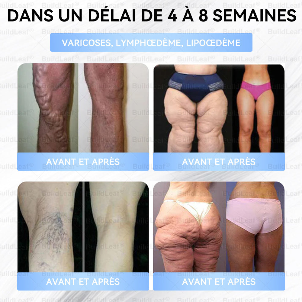 Buildleaf®🎁🎁🎁 Dernière chance ! Saisissez cette opportunité exceptionnelle avec 50 % de réduction !