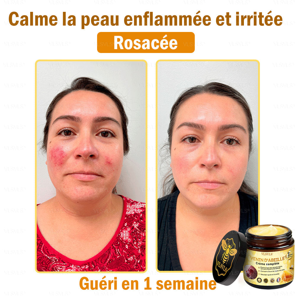 🎁🎁🎁 Il ne reste que 5 pots ! Nous vous offrons une remise supplémentaire de 50 % ! Mettez-vous en forme et en bonne santé. Si vous manquez cette offre, vous n'aurez pas d'autre chance avant l'année prochaine.