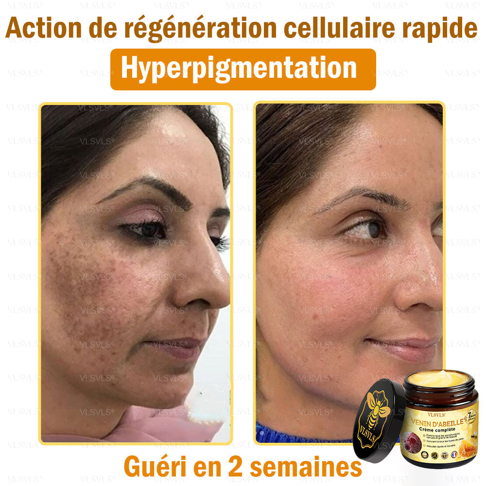 🎁🎁🎁 Il ne reste que 5 pots ! Nous vous offrons une remise supplémentaire de 50 % ! Mettez-vous en forme et en bonne santé. Si vous manquez cette offre, vous n'aurez pas d'autre chance avant l'année prochaine.