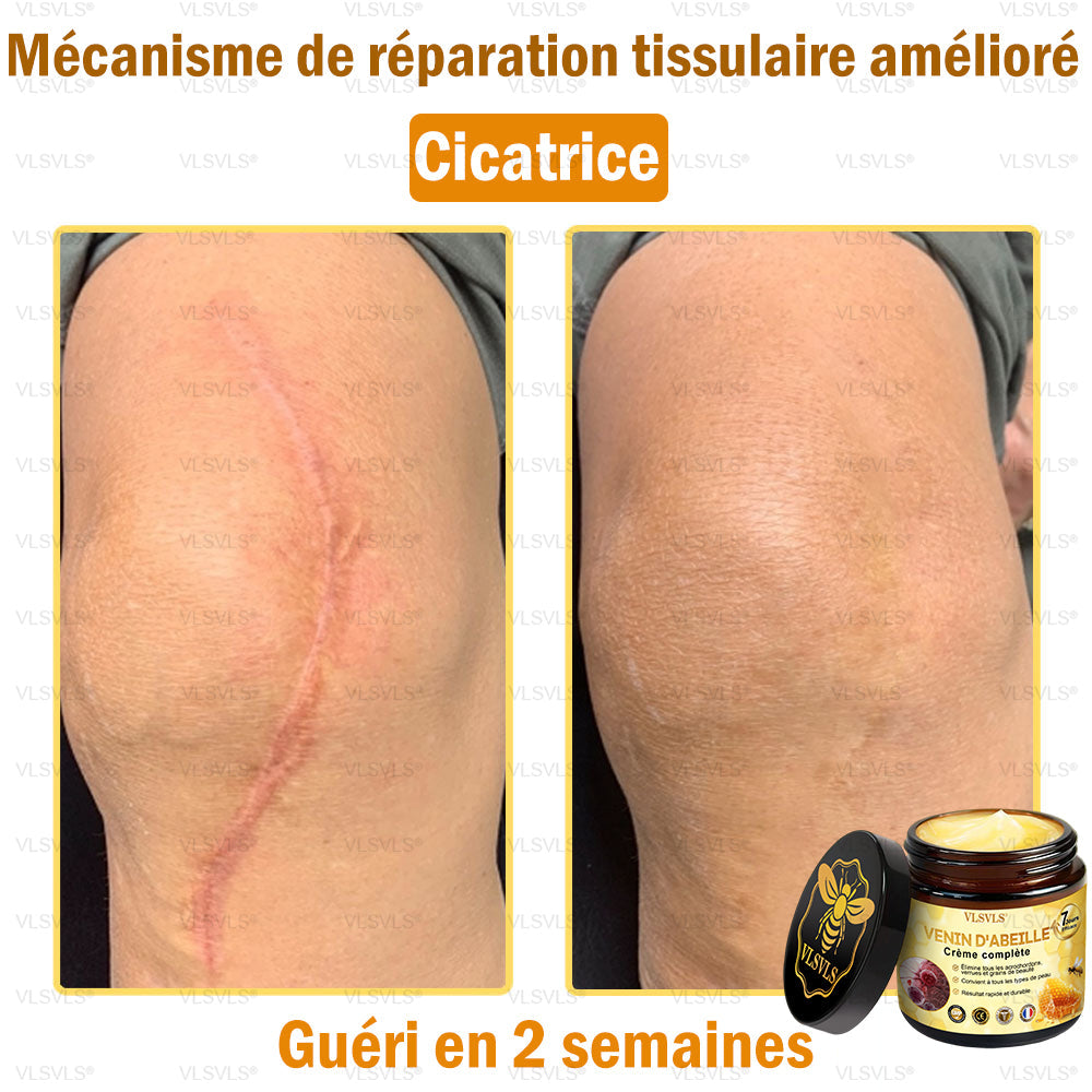 VLSVLS® Venin D'Abeille Crème Complète 🎉🎉(Convient à tous les âges & recommandé par la SFD)