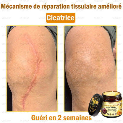 VLSVLS® Venin D'Abeille Crème Complète 🎉🎉(Convient à tous les âges & recommandé par la SFD)