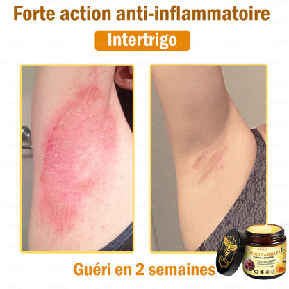 VLSVLS® Venin D'Abeille Crème Complète 🎉🎉(Convient à tous les âges & recommandé par la SFD)