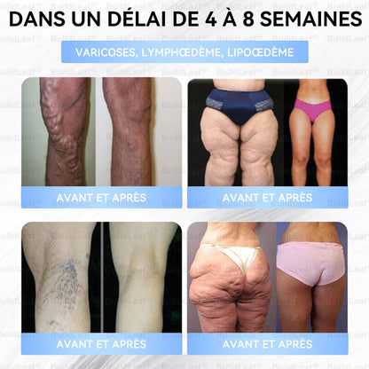 Buildleaf®🎁🎁🎁 Dernière chance ! Saisissez cette opportunité exceptionnelle avec 50 % de réduction !